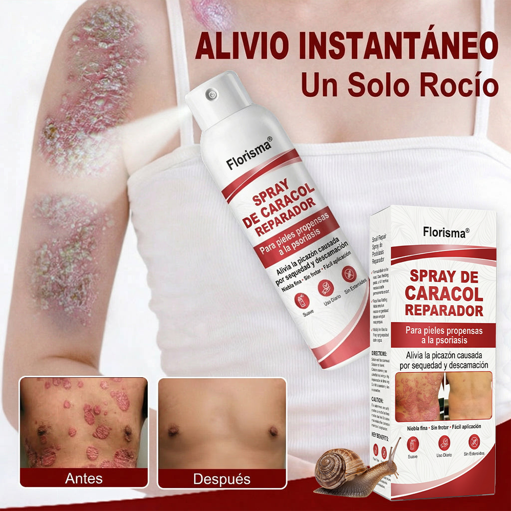 Florisma® 🎉SPRAY DE CADACOL REPARADOR  Para piel con psoriasis, con picazón y descamación💫