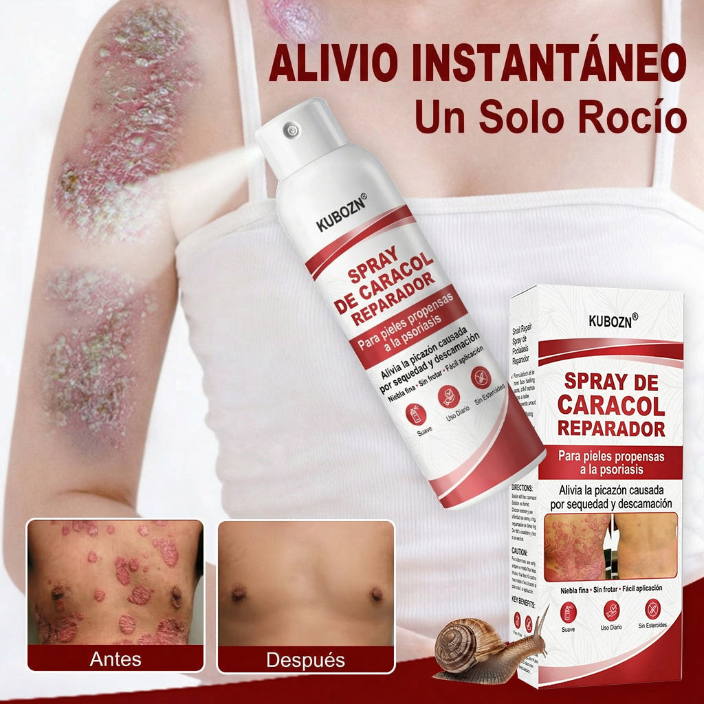 KUBOZN® 🎉SPRAY DE CADACOL REPARADOR  Para piel con psoriasis, con picazón y descamación👑