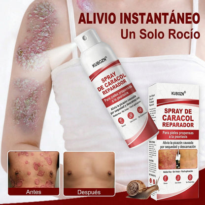 KUBOZN® 🎉SPRAY DE CADACOL REPARADOR  Para piel con psoriasis, con picazón y descamación👑