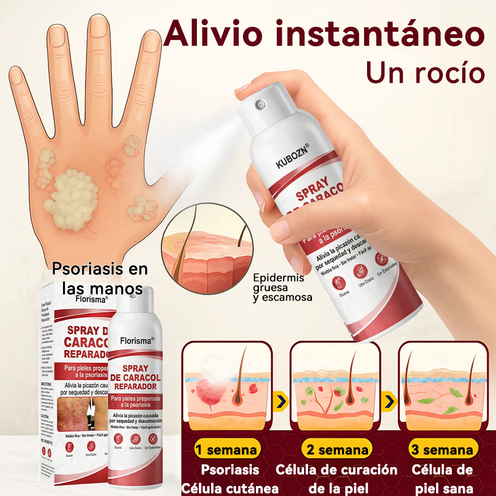 Florisma® 🎉SPRAY DE CADACOL REPARADOR  Para piel con psoriasis, con picazón y descamación💫