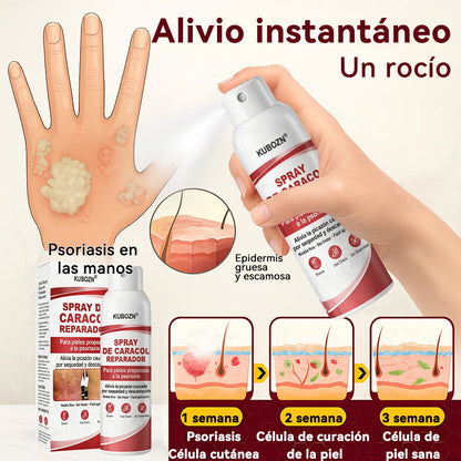 KUBOZN® 🎉SPRAY DE CADACOL REPARADOR  Para piel con psoriasis, con picazón y descamación👑
