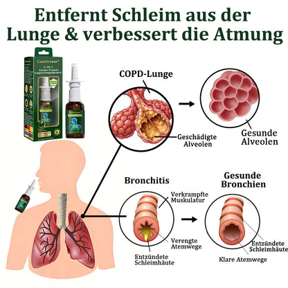 💚🇩🇪 Offizieller Store：CareBreeze® 6-in-1 Kräuter-Propolis Lungenreinigungsspray-Feinzerstäubung(⚡Sofortige Linderung🫁Langzeitwirkungen)
