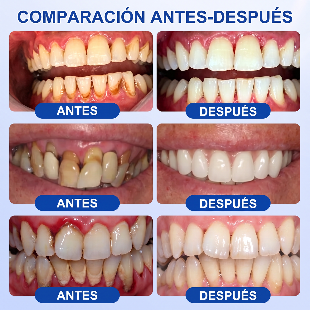 👩‍⚕️𝑮𝒍𝒊𝒎𝒎𝒆𝒓𝒍𝒚® 🦷 𝑮𝒖𝒎𝑹𝒆𝒗𝒊𝒗𝒆 𝑮𝒆𝒍 𝒅𝒆 𝑹𝒆𝒑𝒂𝒓𝒂𝒄𝒊ó𝒏 𝑷𝒂𝒓𝒐𝒅𝒐𝒏𝒕𝒂𝒍 💓