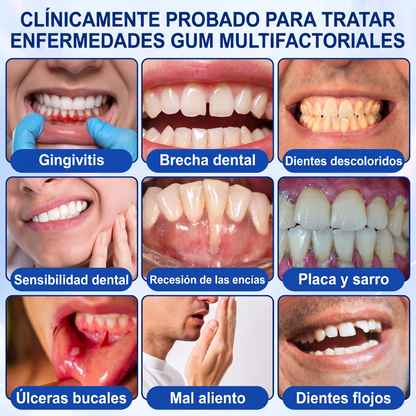 👩‍⚕️𝑮𝒍𝒊𝒎𝒎𝒆𝒓𝒍𝒚® 🦷 𝑮𝒖𝒎𝑹𝒆𝒗𝒊𝒗𝒆 𝑮𝒆𝒍 𝒅𝒆 𝑹𝒆𝒑𝒂𝒓𝒂𝒄𝒊ó𝒏 𝑷𝒂𝒓𝒐𝒅𝒐𝒏𝒕𝒂𝒍 💓