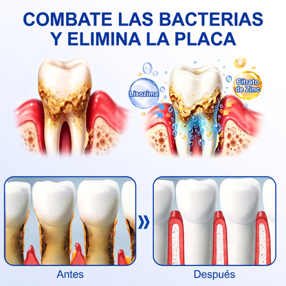 👩‍⚕️𝑮𝒍𝒊𝒎𝒎𝒆𝒓𝒍𝒚® 🦷 𝑮𝒖𝒎𝑹𝒆𝒗𝒊𝒗𝒆 𝑮𝒆𝒍 𝒅𝒆 𝑹𝒆𝒑𝒂𝒓𝒂𝒄𝒊ó𝒏 𝑷𝒂𝒓𝒐𝒅𝒐𝒏𝒕𝒂𝒍 💓