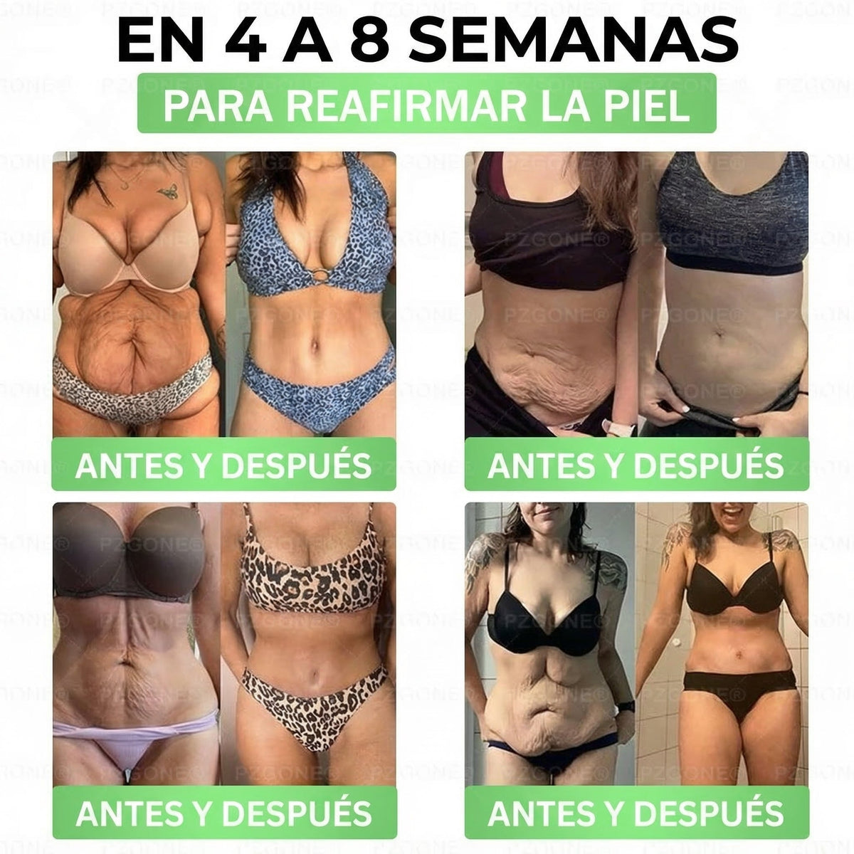 𝑳𝒖𝒙𝒂𝒓𝒊𝒔𝒆® 🍃 Moringa & Berberina 10 en 1 Parche Avanzado de Microagujas Nano 🎉 (Uso diario, cambios visibles en 7 días) Obesidad, Diabetes, Apnea del Sueño y Problemas Articulares