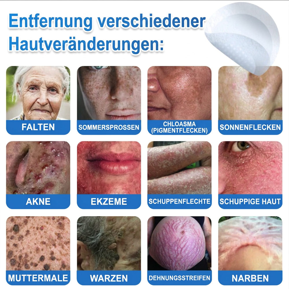 🌿  Fabricado en Alemania | Parche 2 en 1 de microagujas e hidrocoloide | Ayuda a mejorar la apariencia de lunares elevados, acné, verrugas planas y acrocordones | Ayuda a mejorar arrugas, cicatrices e imperfecciones de la piel