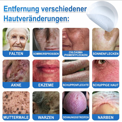 🌿  Fabricado en Alemania | Parche 2 en 1 de microagujas e hidrocoloide | Ayuda a mejorar la apariencia de lunares elevados, acné, verrugas planas y acrocordones | Ayuda a mejorar arrugas, cicatrices e imperfecciones de la piel