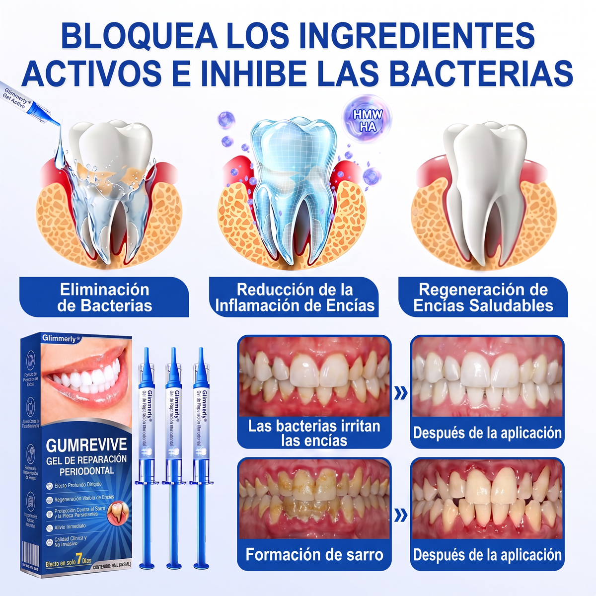 👩‍⚕️𝑮𝒍𝒊𝒎𝒎𝒆𝒓𝒍𝒚® 🦷 𝑮𝒖𝒎𝑹𝒆𝒗𝒊𝒗𝒆 𝑮𝒆𝒍 𝒅𝒆 𝑹𝒆𝒑𝒂𝒓𝒂𝒄𝒊ó𝒏 𝑷𝒂𝒓𝒐𝒅𝒐𝒏𝒕𝒂𝒍 💓