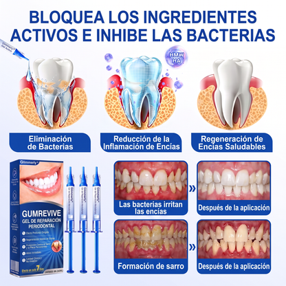 👩‍⚕️𝑮𝒍𝒊𝒎𝒎𝒆𝒓𝒍𝒚® 🦷 𝑮𝒖𝒎𝑹𝒆𝒗𝒊𝒗𝒆 𝑮𝒆𝒍 𝒅𝒆 𝑹𝒆𝒑𝒂𝒓𝒂𝒄𝒊ó𝒏 𝑷𝒂𝒓𝒐𝒅𝒐𝒏𝒕𝒂𝒍 💓