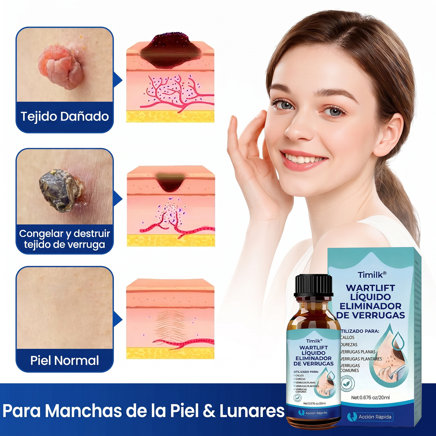 🥰Timilk® WARTLIFT LiQUIDO ELIMINADOR DE VERRUGAS 🥕
