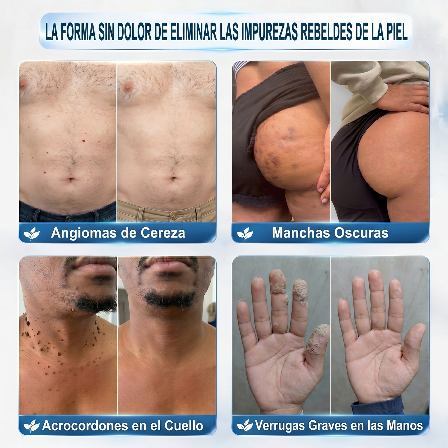 💚𝐁𝐨𝐫𝐫𝐚𝐝𝐨𝐫 𝐝𝐞 𝐕𝐞𝐫𝐫𝐮𝐠𝐚𝐬 𝐲 𝐌𝐚𝐧𝐜𝐡𝐚𝐬 𝐝𝐞 𝟕 𝐃í𝐚𝐬(Aplicador roll-on: sin do🍵