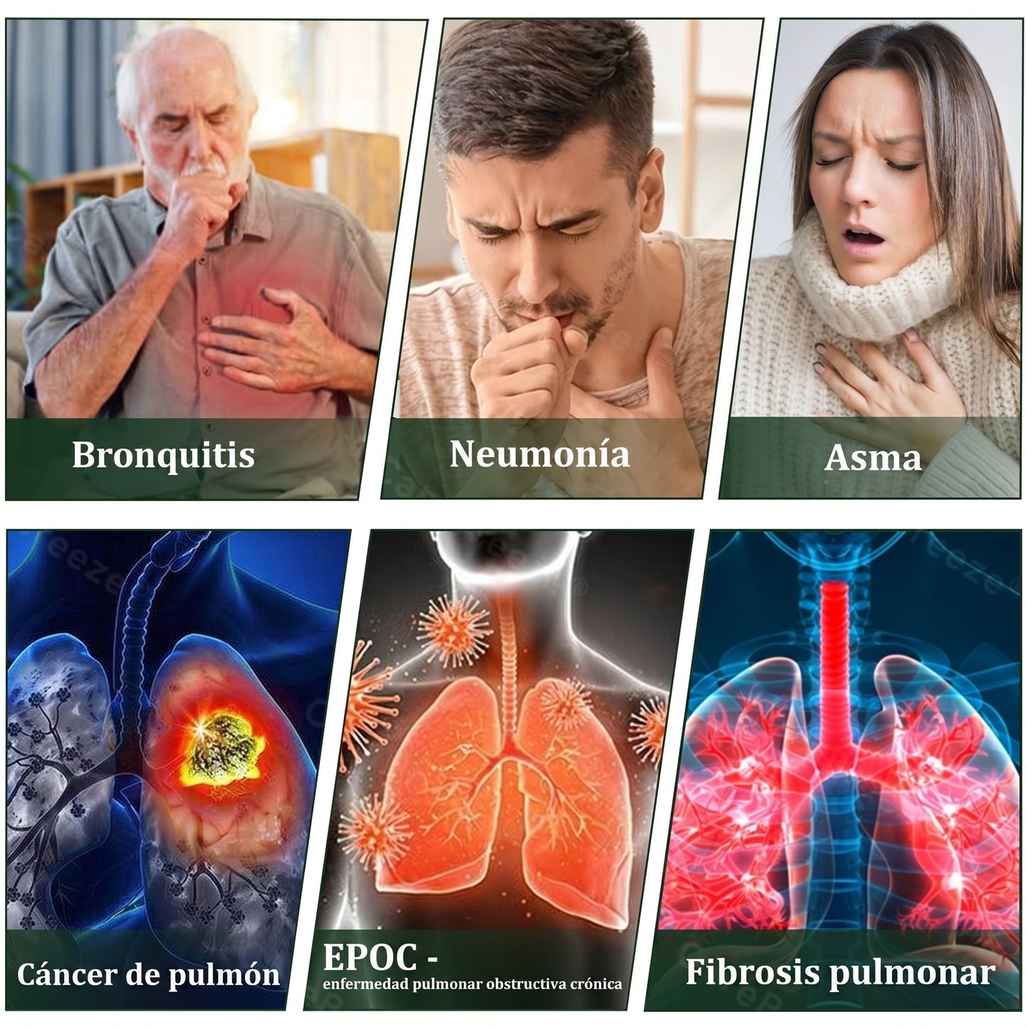 💚💫Tienda oficial：Florisma® Spray de Limpieza Pulmonar de Propóleo de Hierbas 6 en 1(Alivio inmediato, efectos a largo plazo)