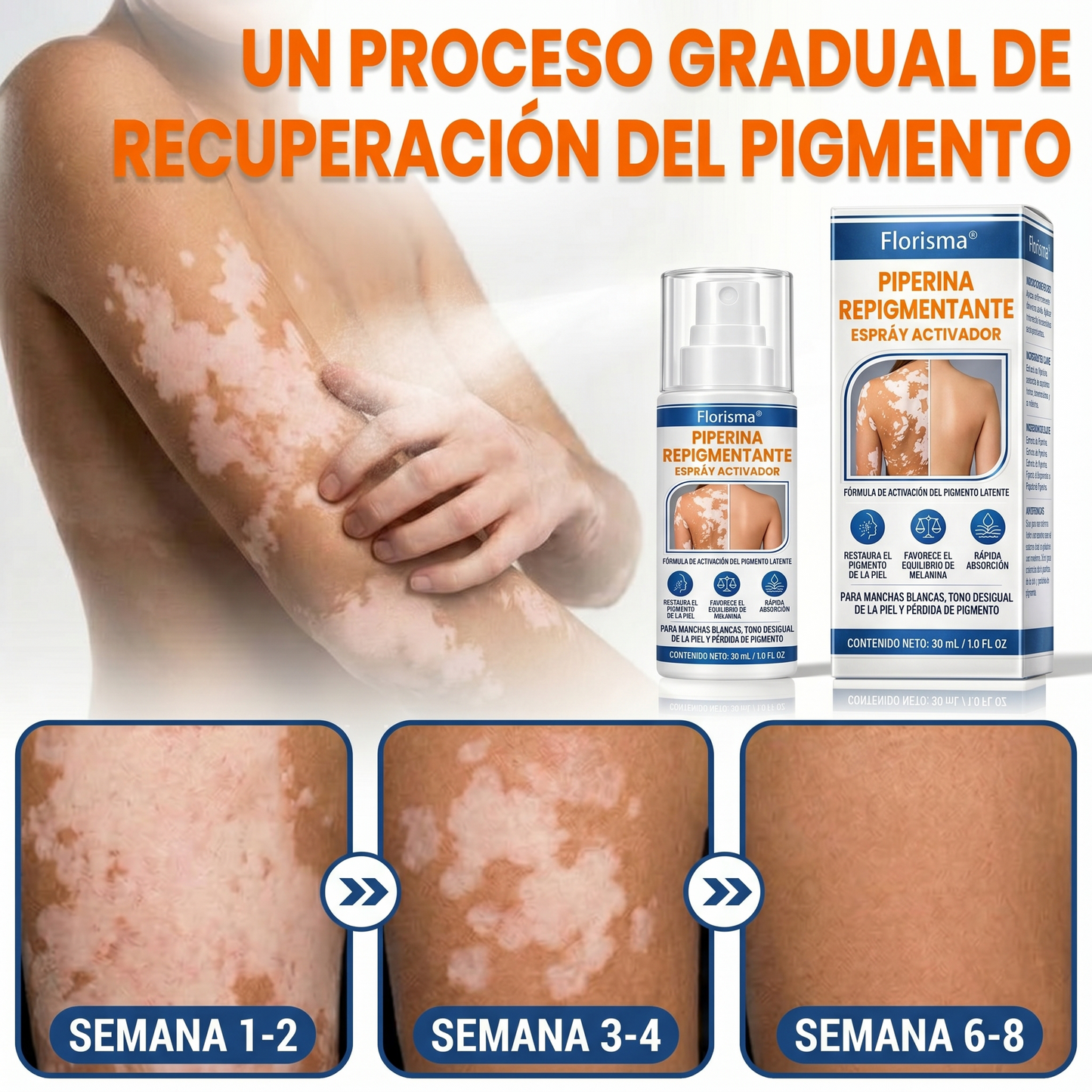 💙🍨 El spray activador de pigmentación Florisma® activa los melanocitos inactivos y restaura el tono natural de la piel.