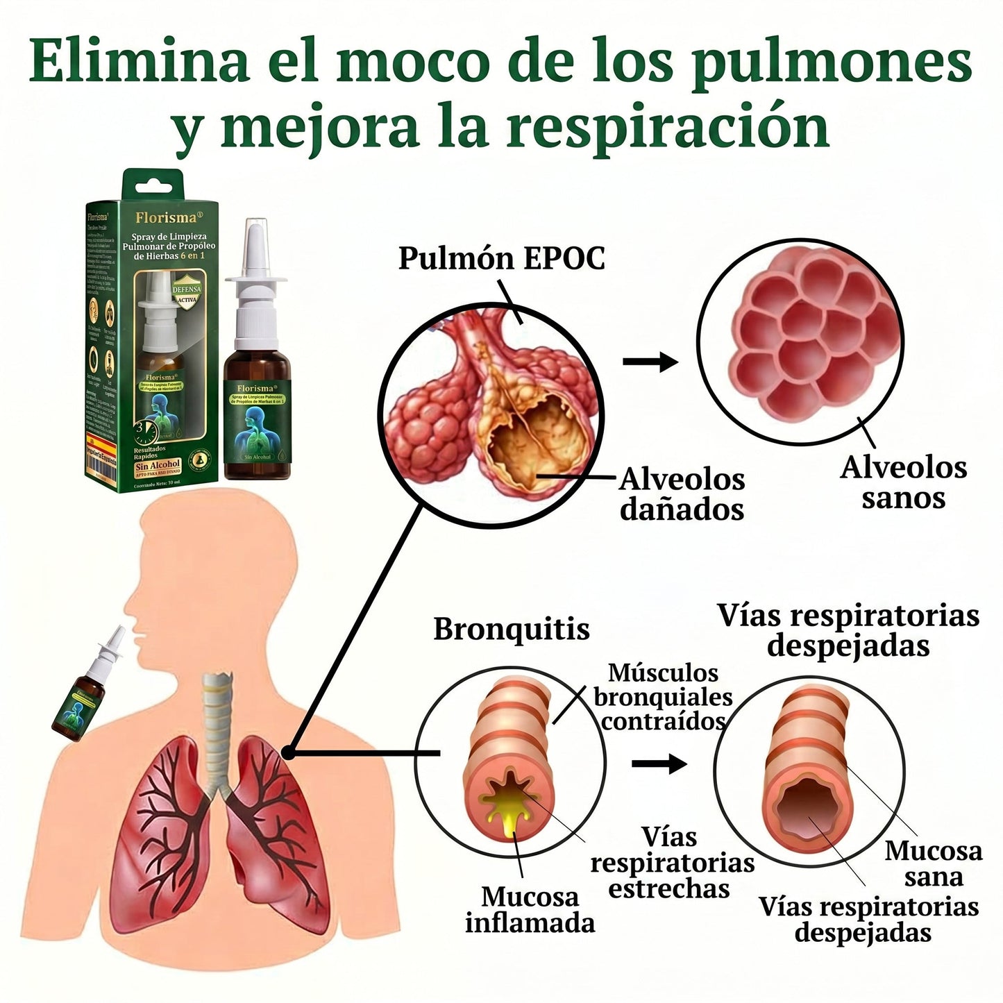 💚💫Tienda oficial：Florisma® Spray de Limpieza Pulmonar de Propóleo de Hierbas 6 en 1(Alivio inmediato, efectos a largo plazo)
