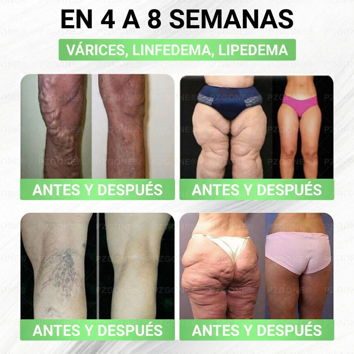 𝑳𝒖𝒙𝒂𝒓𝒊𝒔𝒆® 🍃 Moringa & Berberina 10 en 1 Parche Avanzado de Microagujas Nano 🎉 (Uso diario, cambios visibles en 7 días) Obesidad, Diabetes, Apnea del Sueño y Problemas Articulares