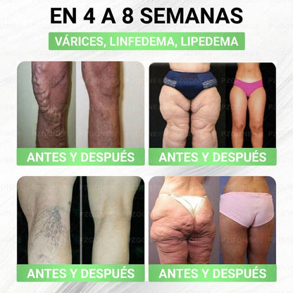 𝑳𝒖𝒙𝒂𝒓𝒊𝒔𝒆® 🍃 Moringa & Berberina 10 en 1 Parche Avanzado de Microagujas Nano 🎉 (Uso diario, cambios visibles en 7 días) Obesidad, Diabetes, Apnea del Sueño y Problemas Articulares