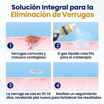 KUBOZN®🌿ChillErase Spray de Renovación contra Protuberancias💫