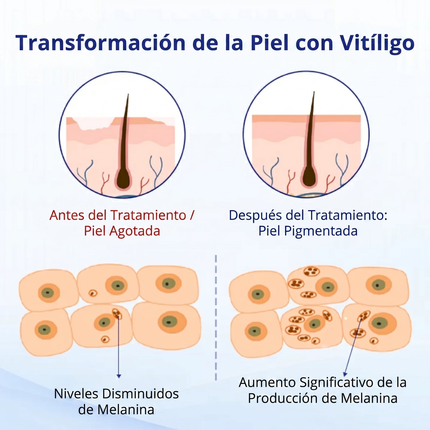 Florisma®🌷🥑 spray de cuidado para el vitíligo – resultados visibles en pocas semanas, 100 % natural y sin esteroides