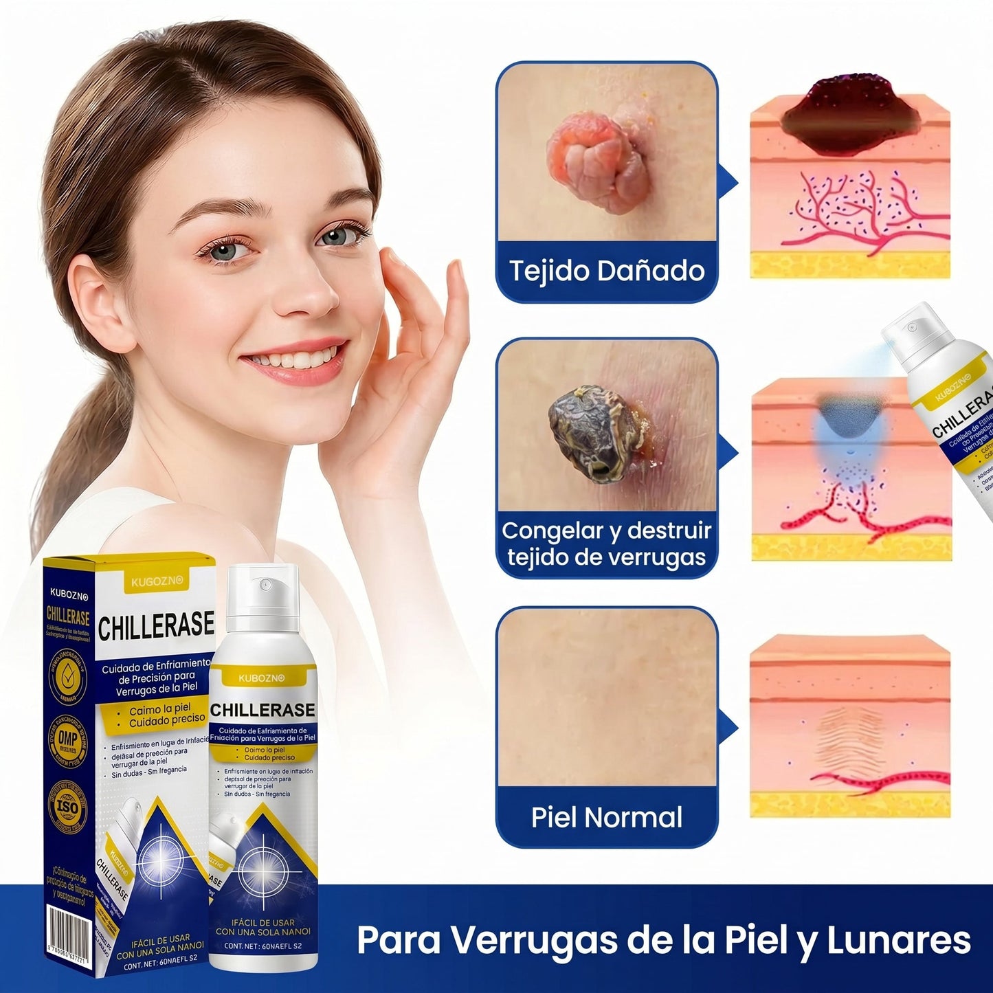 KUBOZN®🌿ChillErase Spray de Renovación contra Protuberancias💫