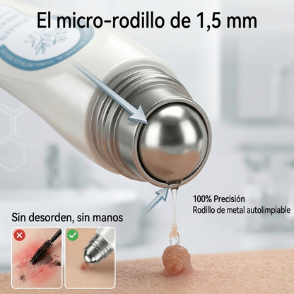 💚𝐁𝐨𝐫𝐫𝐚𝐝𝐨𝐫 𝐝𝐞 𝐕𝐞𝐫𝐫𝐮𝐠𝐚𝐬 𝐲 𝐌𝐚𝐧𝐜𝐡𝐚𝐬 𝐝𝐞 𝟕 𝐃í𝐚𝐬(Aplicador roll-on: sin do🍵