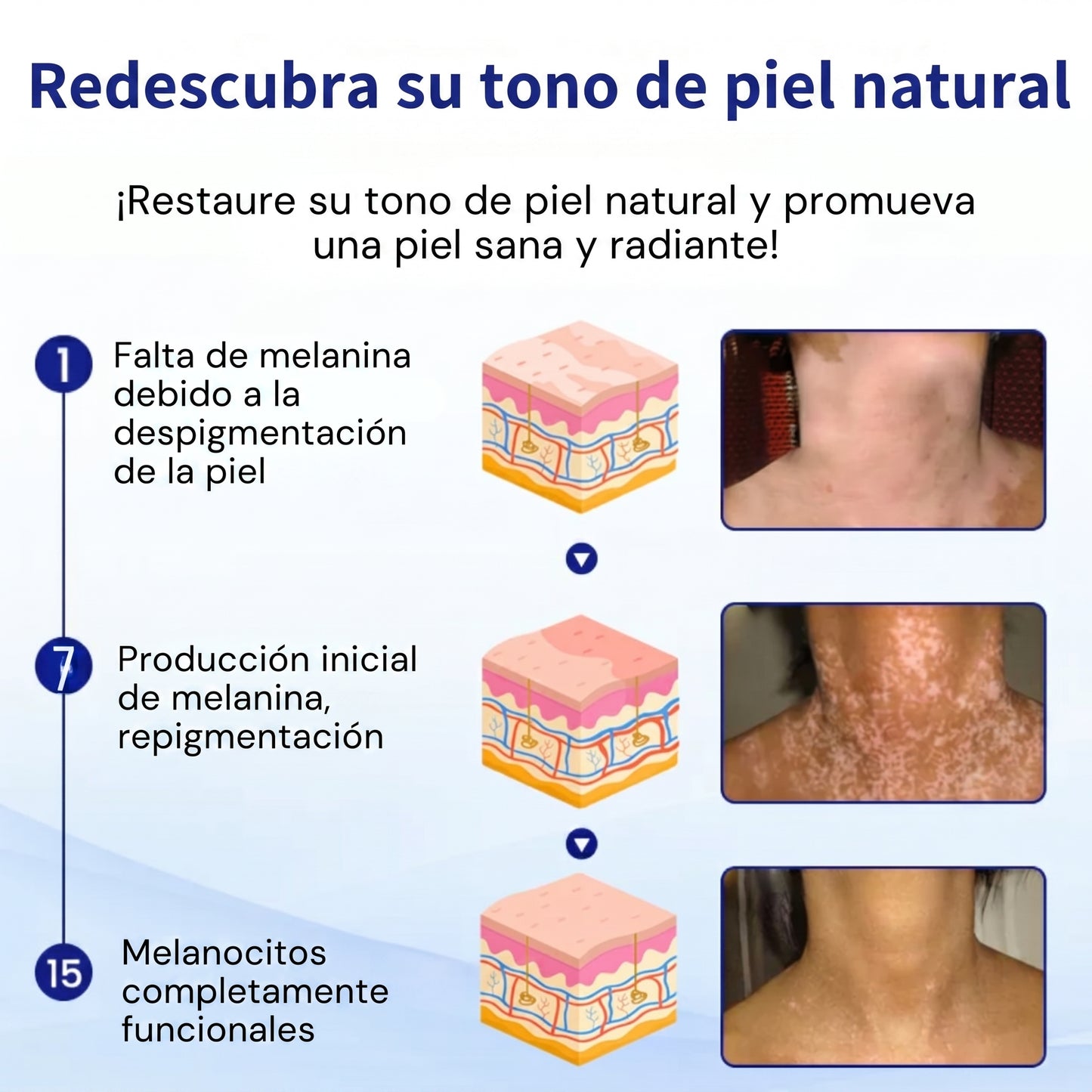 Florisma®🌷🥑 spray de cuidado para el vitíligo – resultados visibles en pocas semanas, 100 % natural y sin esteroides