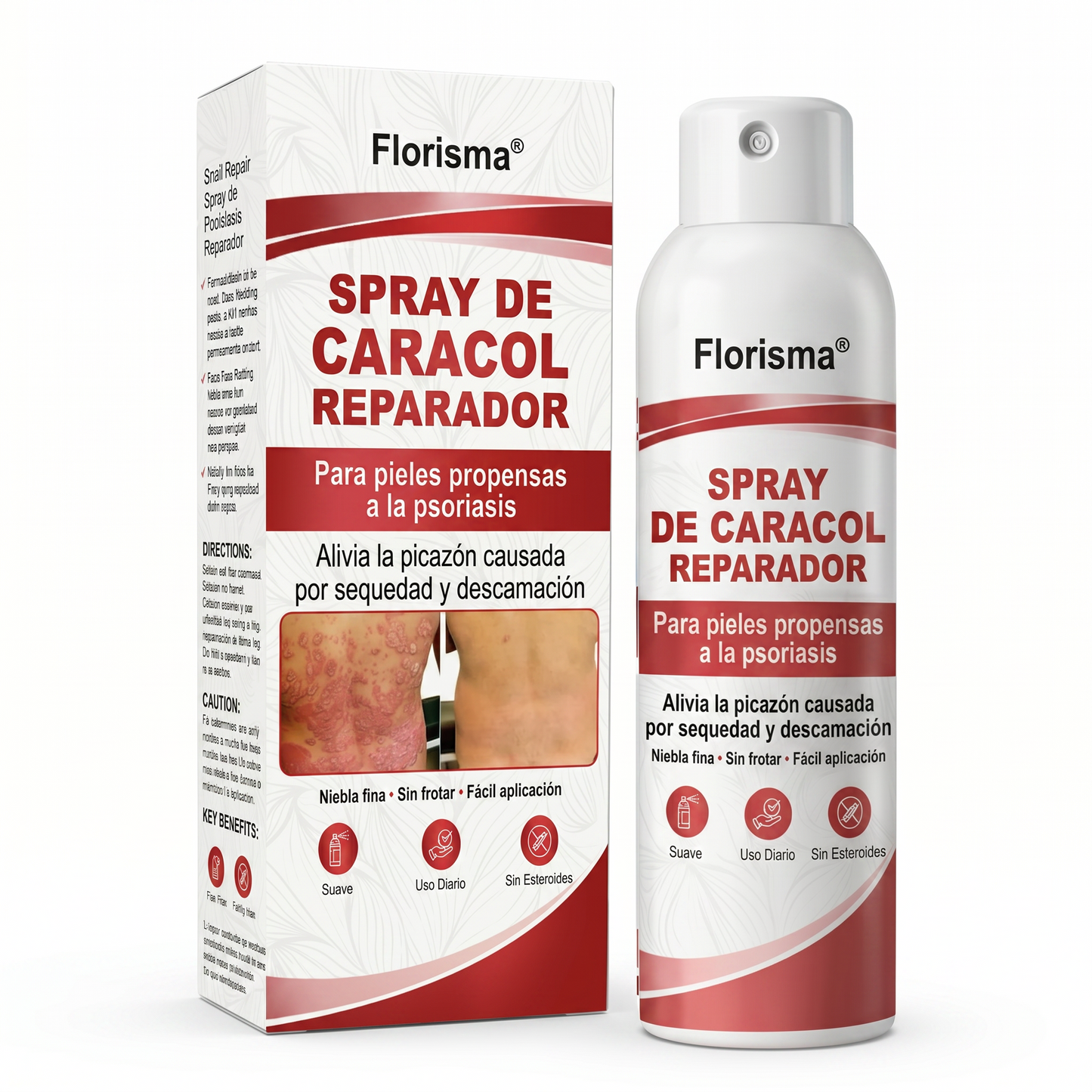 Florisma® 🎉SPRAY DE CADACOL REPARADOR  Para piel con psoriasis, con picazón y descamación💫